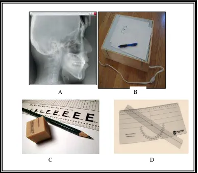 Gambar 8. Alat dan bahan penelitian : (A) Roentgen foto sefalometri lateral (B) (D) Tracing box, kertas asetat tracing (C) Pensil, penghapus, penggaris  Cephalometric protractor 