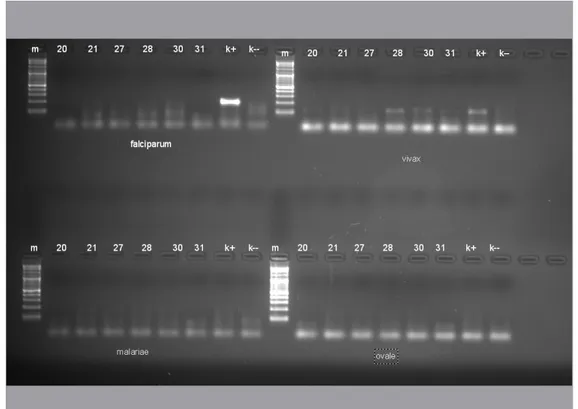 Gambar 1. Pita Nested PCR presipitasi etidium bromide pada agarose gel Keterangan : 