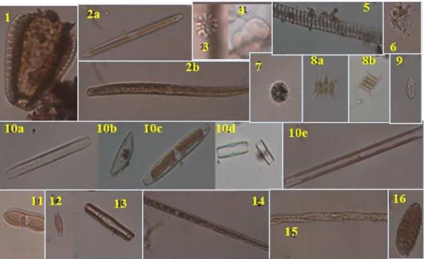 Gambar 2. Biota Mikro yang Ditemukan di Tempat Perkembangbiakan Anopheles spp.  Keterangan: 