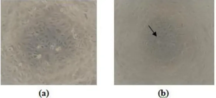 Gambar  3.  Efek  perlakuan  isolat  1  terhadap  sel  Vero.  Pengamatan  dilakukan  di  bawah  mikroskop  inverted  dengan  pembesaran  100x