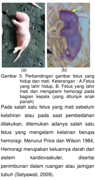 Gambar  3.  Perbandingan  gambar  fetus  yang  hidup dan mati. Keterangan : A.Fetus  yang  lahir  hidup,  B