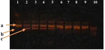 Figure 1 The electrophoregram of cleaving of supercoiled pUC 19 by peel       protein extract of white sweet potato