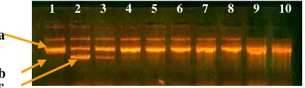 Figure 3    The electrophoregram of cleaving of supercoiled pUC 19 by peel    protein extract of purple sweet potato