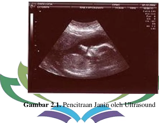 Gambar 2.1. Pencitraan Janin oleh Ultrasound 