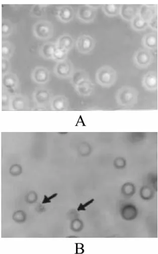 Fig. 3. Induction of DNA fragmentation in HeLa cellsDNA isolation. Characteristic apoptotic DNA ladder(A) but not in Raji cells(B)