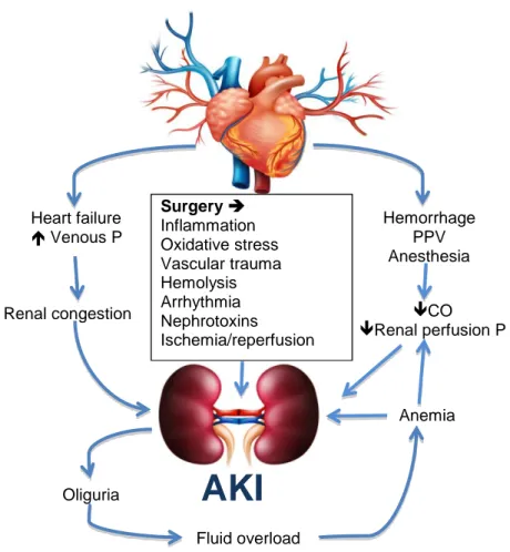 Figure  4.  A  schematic  representation  of  factors  that  contribute  to  AKI  in  the 