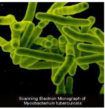 Gambar 2.2. Mycobacterium tuberculosis, gram positif, organisme obligat aerob22 