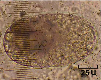 Gambar 5. Telur Sp. 2 (Enoplida) yang ditemukan pada isi usus hamster di kota Padang. 
