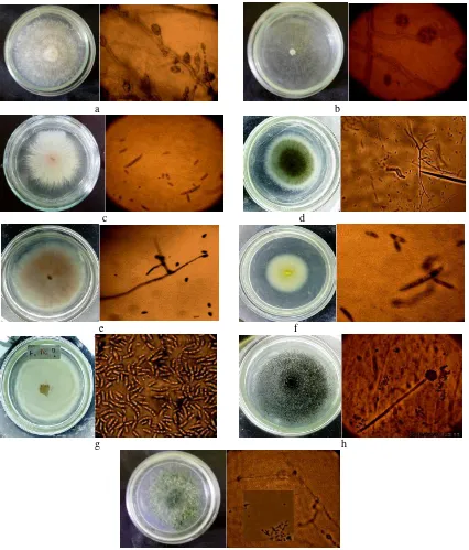 Gambar 1. Makroskopis dan Mikroskopis koloni jamur: a) Fusarium sp. 1; b) Fusarium sp