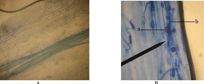 Gambar 3. Akar tanaman jarak pagar yang diberi pewarnaan staining (Perbesaran   100x), akar tanaman inang jarak pagar Glomus yang tidak terinfeksi spora Glomus (A), akar tanaman inang jarak pagar yang terinfeksi  (B), a (vesikula), b (hifa internal) 