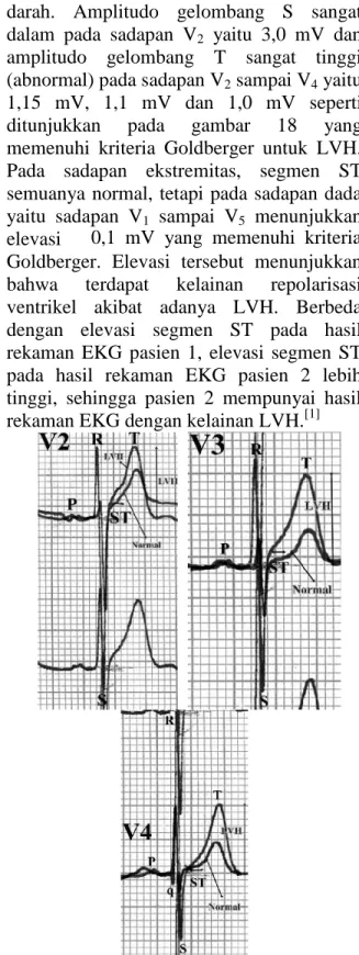 Gambar 17. Sumbu  listrik  jantung  seluruh  pasien. Sumbu  listrik  jantung  mewakili  arah  depolarisasi jantung.