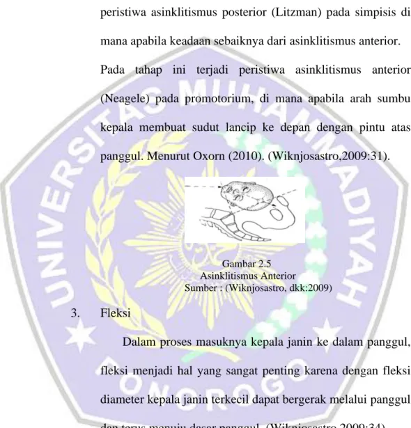 Gambar 2.5  Asinklitismus Anterior 