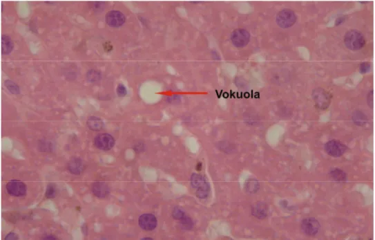 Gambar 3.  Penampang  melintang  hepar  R. norvegicus infektif Leptospira sp. pada  perbesaran 1000 x