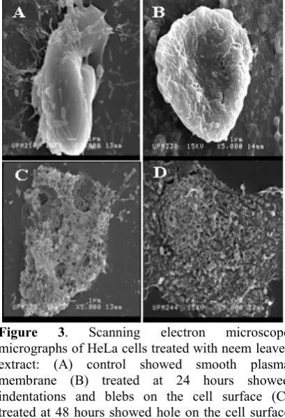 Figure 2. Confocal micrograph of MCF-7 cells,untreated cells(A), treated cells after exposed toethanolicextractofA.India(neem)showschromatin condensation (B), Initial morphologicalappearanceofnucleusfragmentation(C),fragmented nucleus (D).