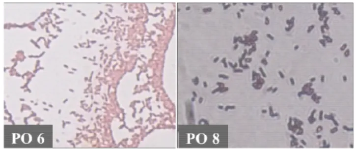 Gambar  1.  Pewarnaan  Gram  isolat  PO6  (Gram  +  Basil)  dan  PO8  (Gram  -  Basil) 