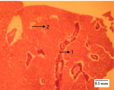 Gambar 2.  Struktur  jaringan  hati  benih  kakap  putih  dan  perubahan    yang  dipengaruhi  oleh  pemaparan  Hg(NO 3 ) 2  dengan konsentrasi 0,0316 ppm (HE)