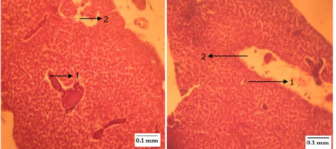 Gambar 3.  Struktur  jaringan  hati  benih  kakap  putih  dan  perubahan  yang  dipengaruhi  oleh  pemaparan  merkuri nitrat (Hg(NO 3 ) 2 ) dengan konsentrasi 0,099 ppm (HE)
