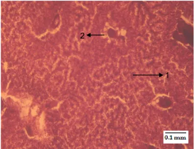 Gambar 4.  Struktur  jaringan  hati  benih  kakap  putih  dan  perubahan  yang  dipengaruhi  oleh  pemaparan  merkuri nitrat (Hg(NO 3 ) 2 ) dengan konsentrasi 0,316 ppm (HE)