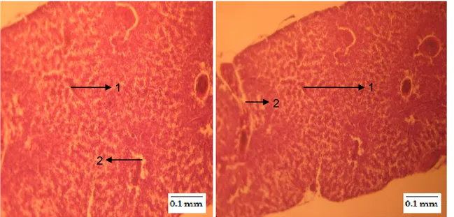 Gambar 5.   struktur  jaringan  hati  benih  kakap  putih  dan  perubahan  yang  dipengaruhi  oleh  pemaparan  Hg(NO 3 ) 2  dengan konsentrasi 0,997 ppm dan letal pada jam ke 12 waktu pemaparan