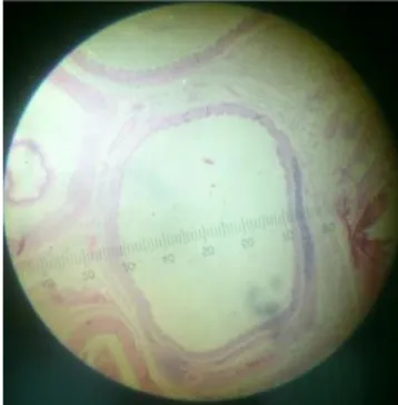 Gambar 11.  Panjang diameter bronkus (µm)  pada kelompok hewan uji Pertamax (P1), (He,  100x10)
