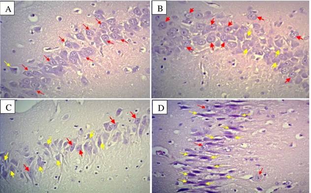 Gambar 1. Gambaran Histologi Hipokampus. Kelompok kontrol normal (A); kelompok P1 (B);  kelompok P2 (C); kelompok P3 (D)