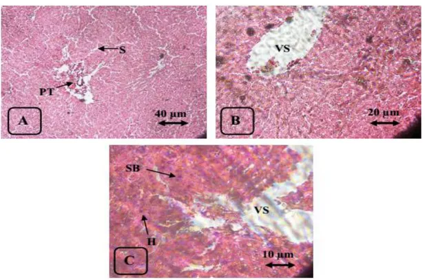 Gambar 1. Struktur mikroskopis hepar tikus Wistar pada kontrol, pewarnaan HE 