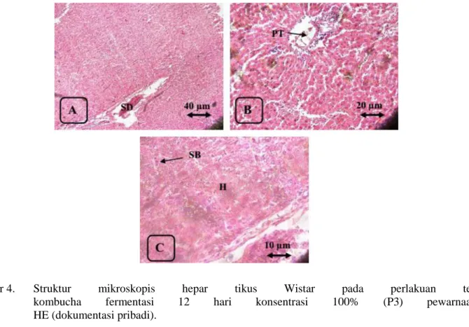 Gambar 4.  Struktur  mikroskopis  hepar  tikus  Wistar  pada  perlakuan  teh  kombucha  fermentasi  12  hari  konsentrasi  100%  (P3)  pewarnaan       HE (dokumentasi pribadi)