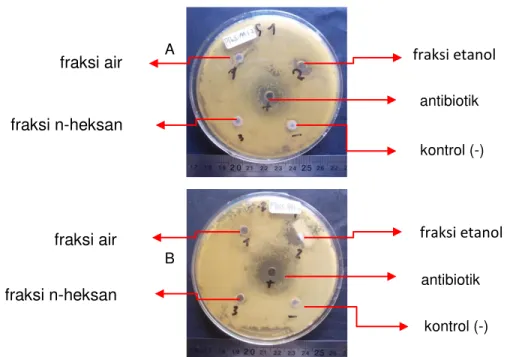 Gambar 7. Hasil pengujian aktivitas anti bakteri fraksi PTWSAA 1.2+S.a  terhadap         bakteri S