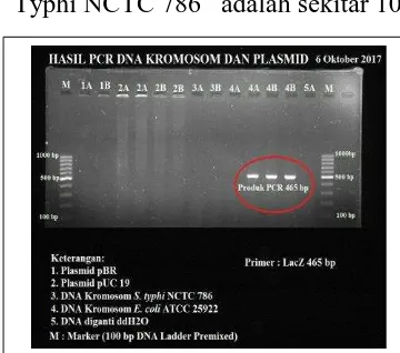 Gambar 2. Hasil PCR DNA kromosom dan plasmid 