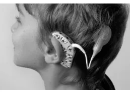 Gambar 1. 11: Modifikasi teknologi Cochlear Implant asistif Tunarungu 