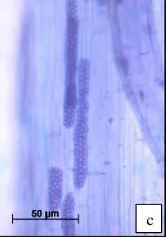 Gambar 1. Mikrosklerosium yang terdapatpada akar jagung (a, b) dan akarpadi (c). Bar = 50 m.