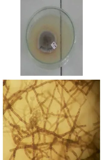 Gambar 4. Hasil isolasi DSE pada media PDAdan foto mikroskopis. Perbesaran400x.