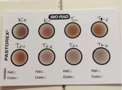 Gambar 1.  Contoh hasil uji serologis sampel serum darah tikus  penelitian menggunakan Pastorex TM  Toxo