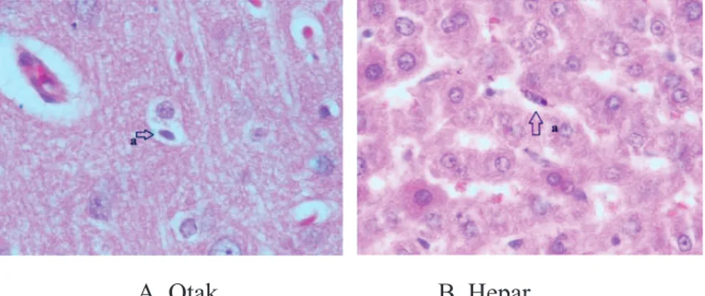 Gambar 2.  Gambaran histopatologis organ otak dan hepar tikus penelitian  A. Otak, B. Hepar