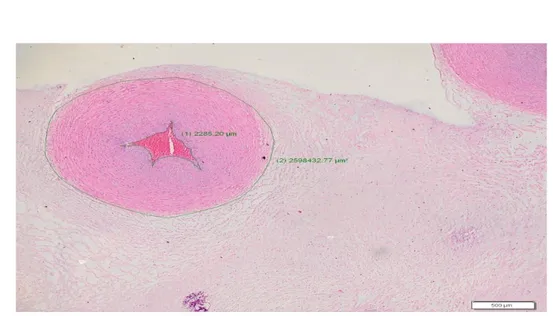 Gambar 2. Diameter lumen arteri umbilikalis pada kehamilan normotensi 