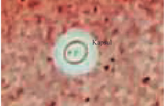 Gambar 1.  Pewarnaan tinta india: sel khamir Cryptococcus neoformans dengan kapsul.