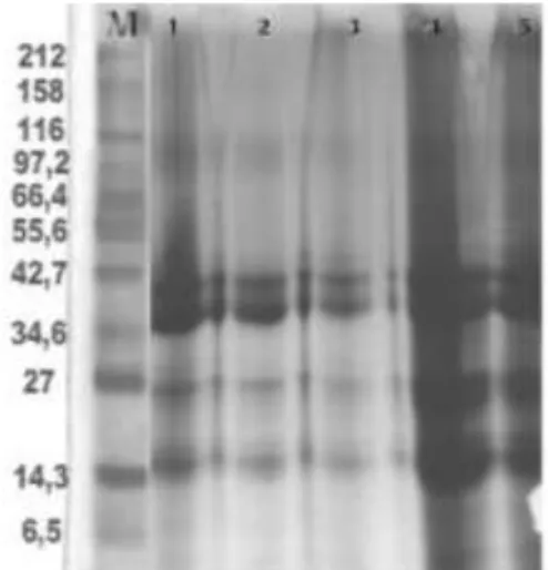 Gambar 3.  Hasil elektroforesis dengan sodium  dodecyl sulphat polyacryalmide gel  electroforesis (SDS-PAGE) pada produk  interaksi protein dengan gum xanthan 