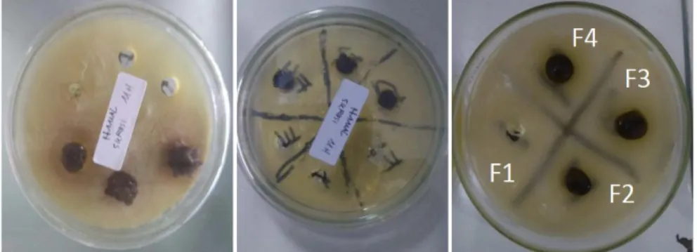 Gambar 9. Hasil uji zona hambat gel ekstrak bunga rosella terhadap Staphylococcus aureus