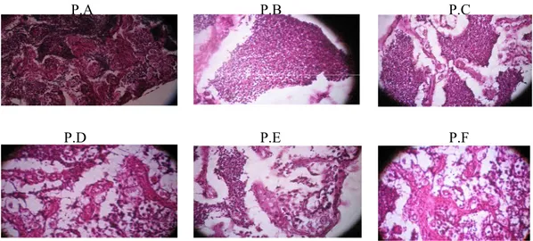 Gambar  5.  Histologi  testis  ikan  pantau  (Rasbora  lateristrata Blkr)  dari masing- masing-masing perlakuan