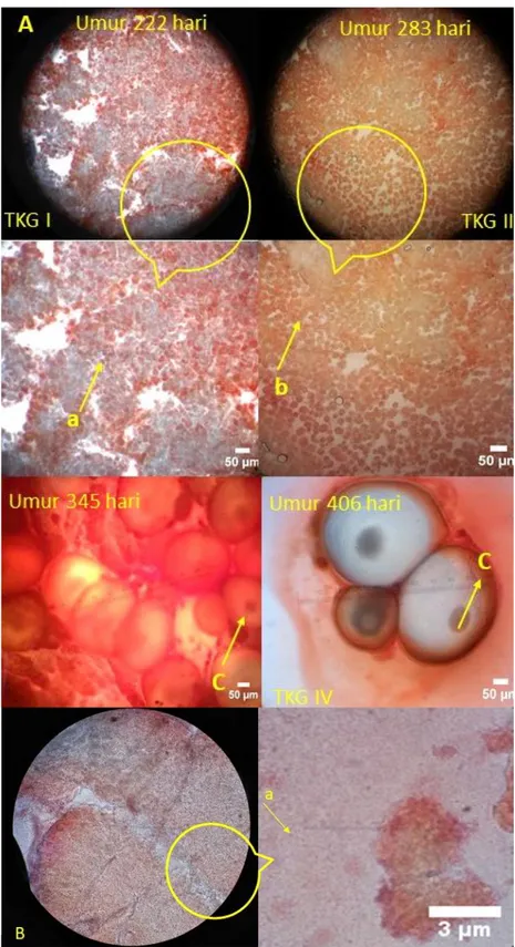 Gambar 7. A)  Preparat  gonad  betina  dengan  pewarnaan  acetocarmine; oogonia  (a),  oosit  (b),  dan  nukleus  (c);  B)  preparat  gonad jantan; spermatozoa (a).