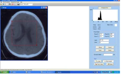 Gambar 1. Citra CT Scan dan histogram 