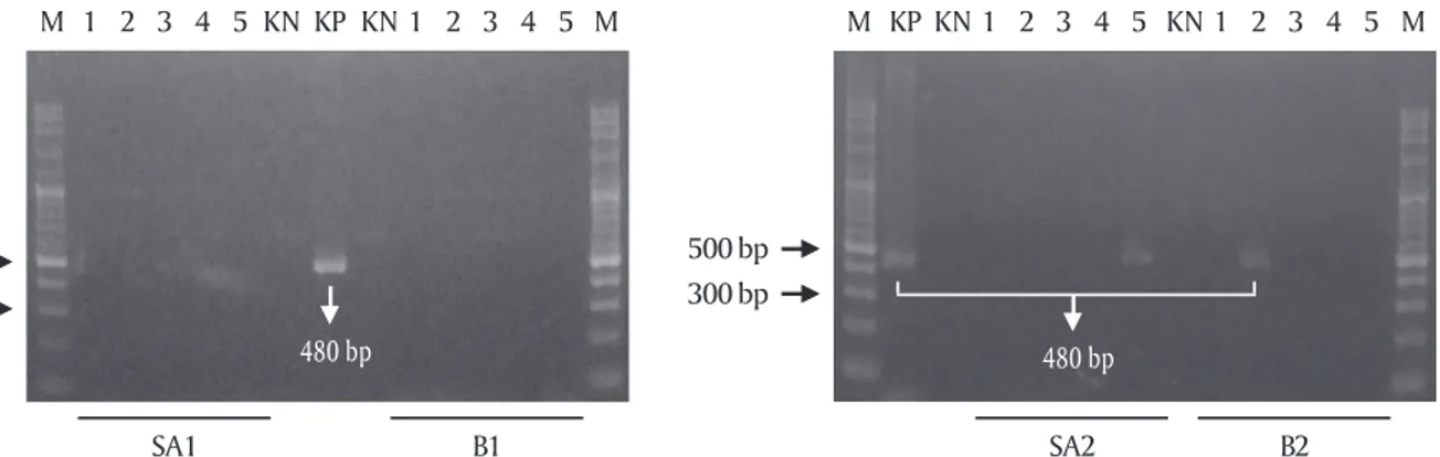 Gambar 1. Deteksi transgen krt-GP11 pada empat garis keturunan (line) larva transgenik F 1 