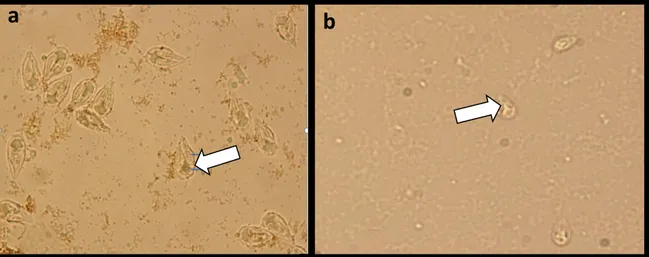 Gambar 2. Spora Myxobolus sp. (panah putih) dengan pewarnaan Lugol’s iodine perbesaran 100X  (Mikroskop Olympus CX31), yang diambil dari ikan koi dengan gejala klinis (a), dan ikan koi tanpa 