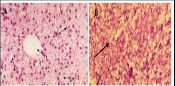 Gambar 6.  Kondisi  histolologi  hati  ikan  mas  (Destiany,  2007)  menunjukkan  bahwa,  gambar  A  ;  Hati  ikan  mas  terlihat  vena  sentralis  (1),  hepatosit  (2),  inti  (3),  sinusoid  (4)  (tanda  panah),  HE,  perbesaran  40x10  (Destiany, 2007)