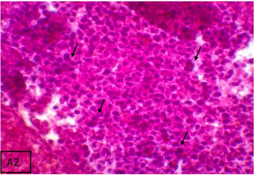 Gambar 9.  Kondisi histolologi hati ikan bandeng menunjukkan bahwa  A2 : Kondisi  histologi hati ikan bandeng mengalami Nekrosis Hepatitis