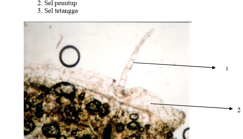 Gambar 4.3. Irisan Epidermis Bawah dengan Stomata Tipe Anisositik  