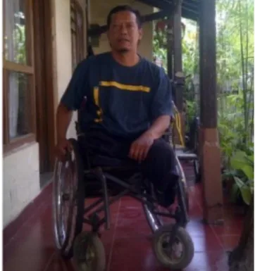 Gambar 1. Penyandang Disabilitas cacat kaki. 