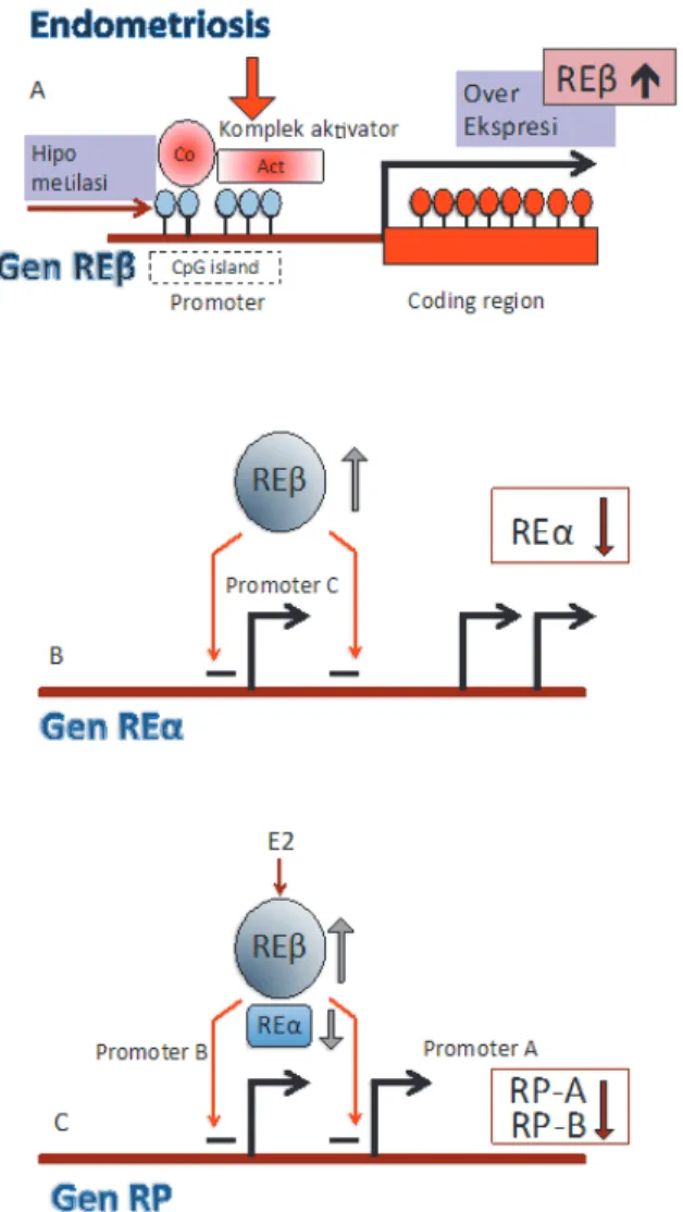 Gambar 4.4  Teori hormon resistensi progesteron. (A) Terjadi hipometilasi CpG island di regio  promoter gen REb di stroma jaringan endometriosis sehingga terjadi aktivasi dan peningkatan  ekspresi REb