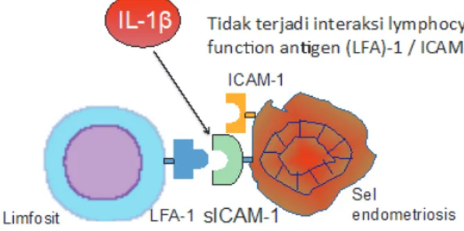 Gambar 4.6  Teori defek sistem imun. (A) Pada perempuan dengan endometriosis aktivitas  sitotoksik sel NK terrepresi (B) Sistem imunsurveilen tidak mampu mengenali sel endometriosis  karena terjadi peningkatan ekspresi sICAM-1 sehingga tidak terjadi intera