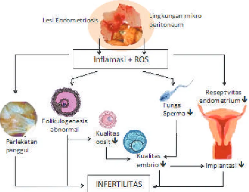 Gambar 7.2  Mekanisme infertilitas pada endometriosis (29)
